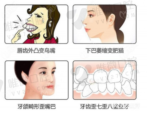 龋齿的区别方法（龋齿不治疗会怎样）相关知识！(图1)